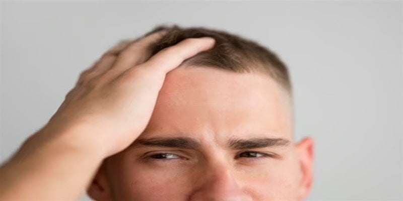 7 Months After Hair Transplant