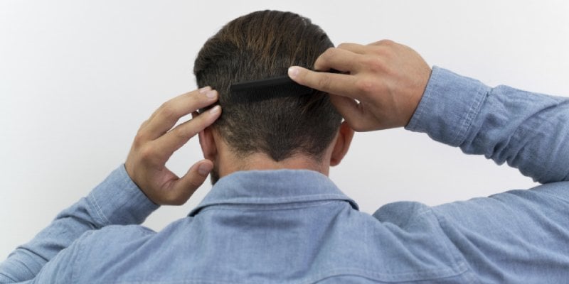 How to Speed Up Hair Growth - Asmed Hair Transplant