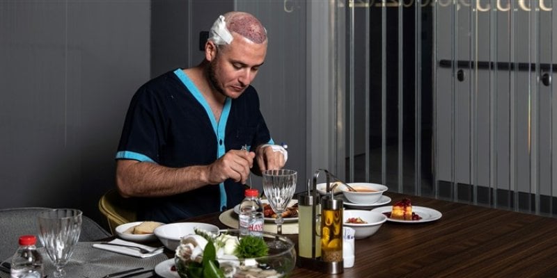 Hair Transplant Recovery Timeline