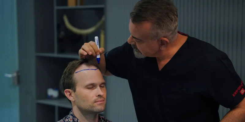 Hair Transplant Approach
