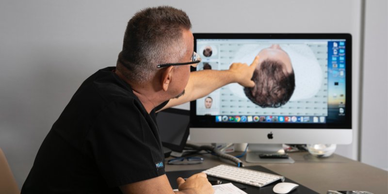 Types of Hair Transplant