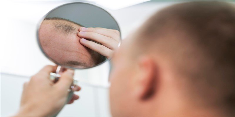 Traction Alopecia: Symptoms, Causes & Treatment