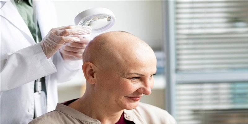 Scarring Alopecia: Symptoms, Causes & Treatment