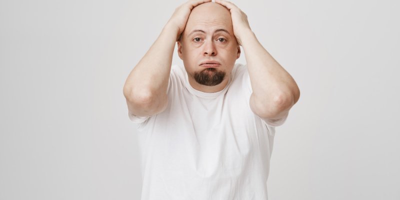 Permanent Hair Loss
