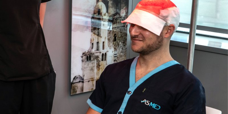 Hair Transplant First Week