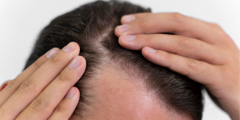 Average Hair Growth Rate