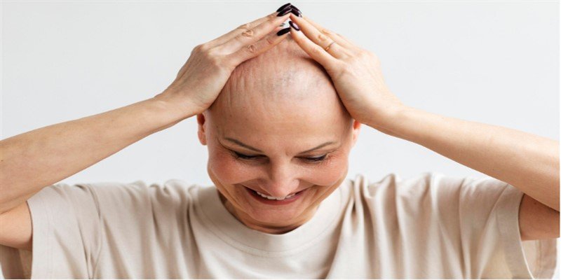 Frontal Fibrosing Alopecia: Symptoms, Causes & Treatment