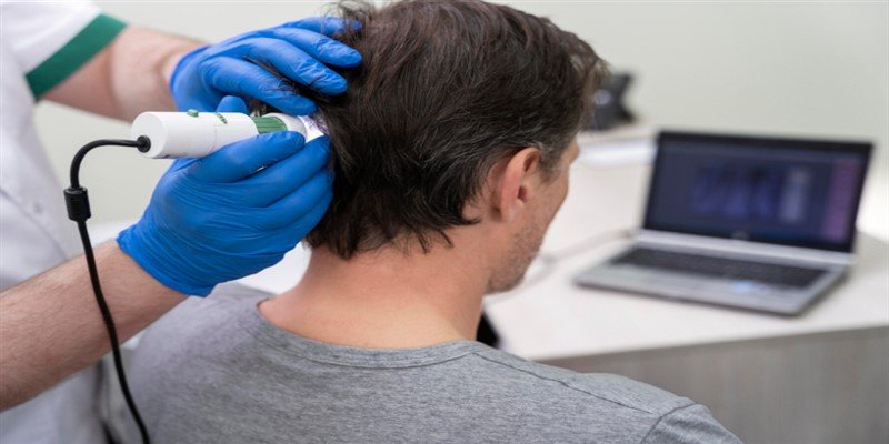 Non-Surgical Hair Restoration