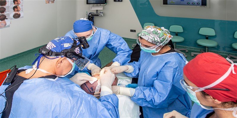 When To Get a Hair Transplant