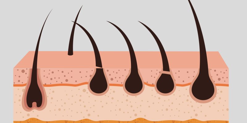 What is a Hair Graft?