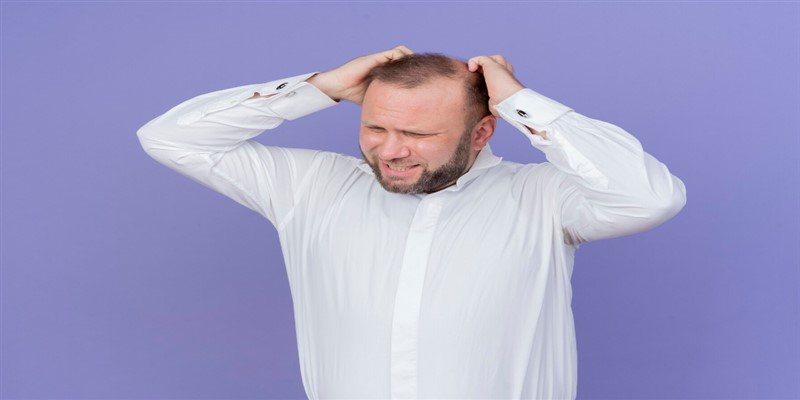 How to Stop Alopecia Areata From Spreading