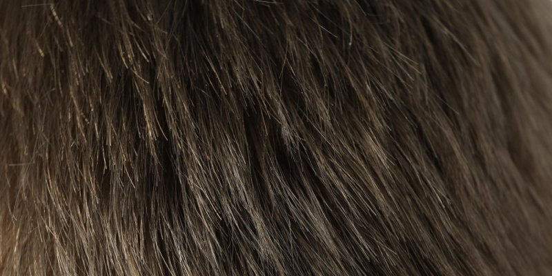 Hair Transplant For Thinning Hair