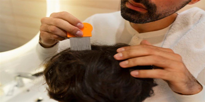 How to Get Rid of Scalp Build Up?