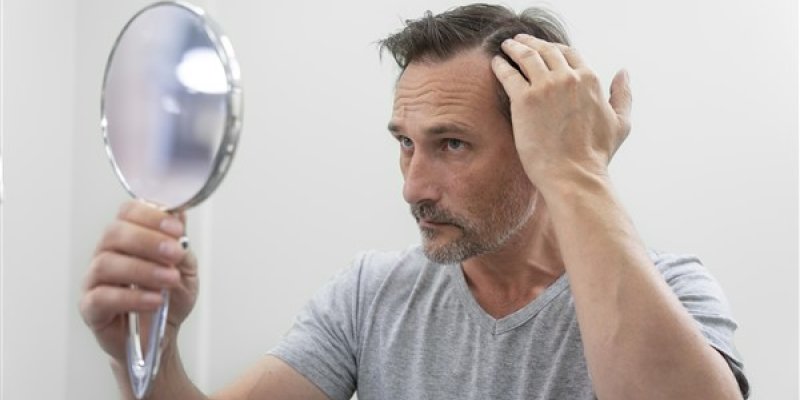 What is the Best Age for Hair Transplant?