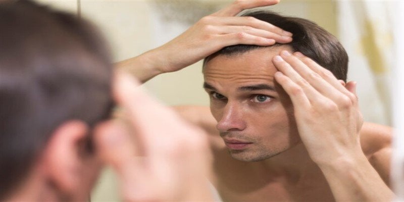 What is Temple Hair Loss? Causes and Treatments