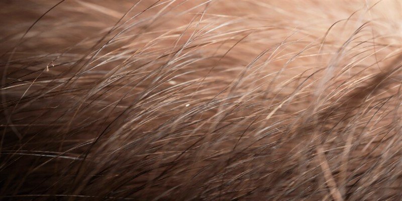 How to Get Rid of Ingrown Hair?