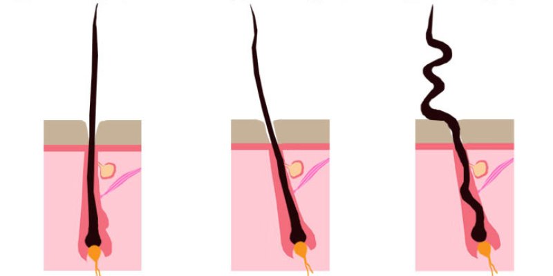 Ethnicity Hair Types