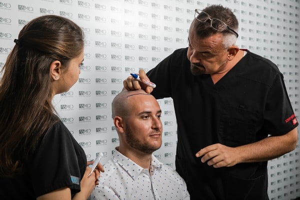 dr koray erdogan hairline design