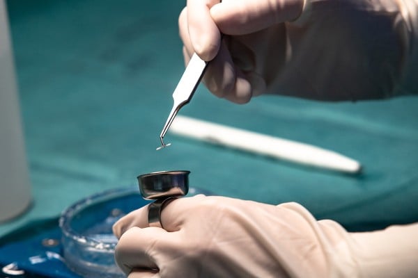 hair transplant graft