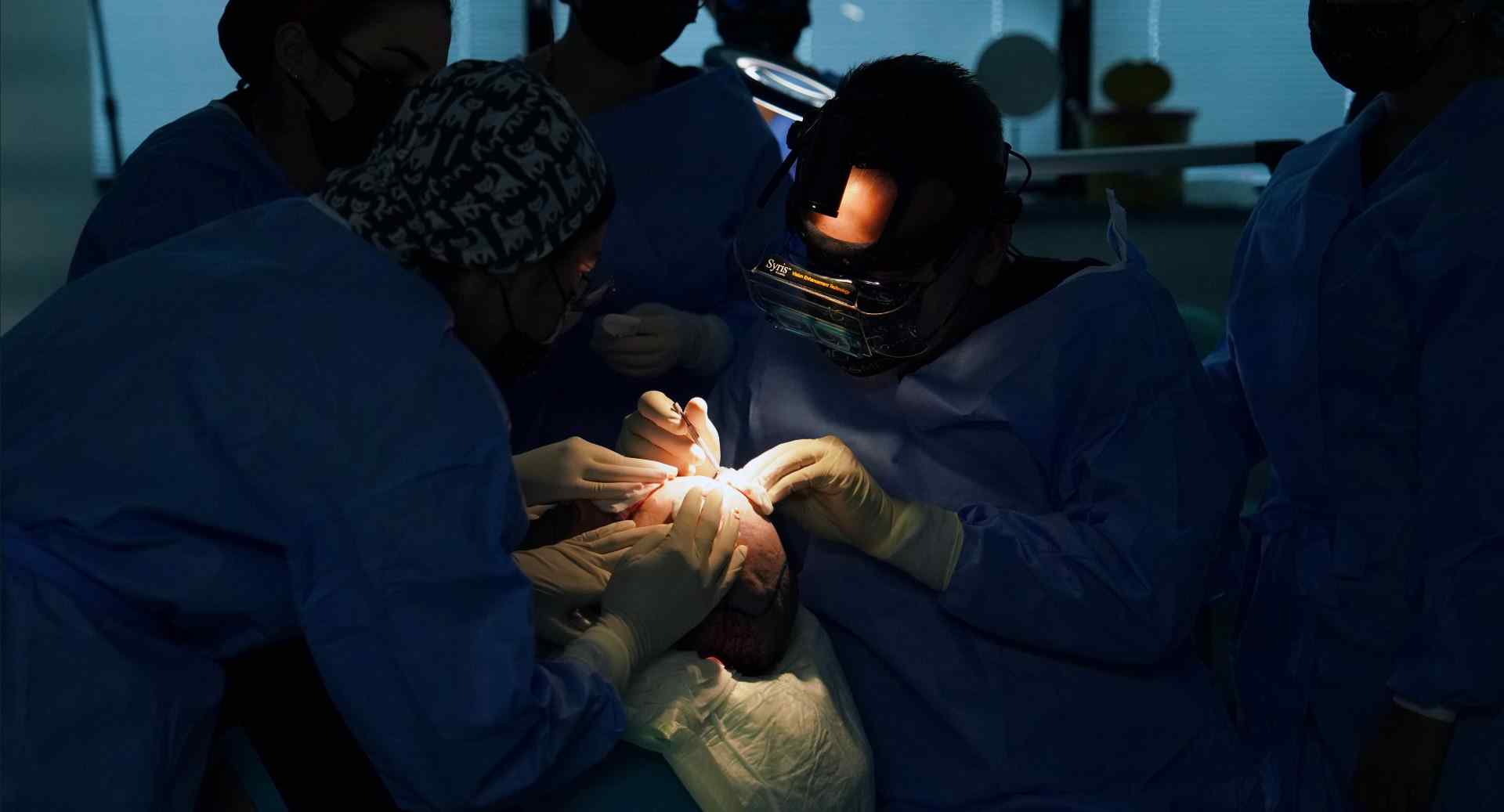 manual fue hair transplant
