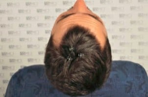 consultation-example-6